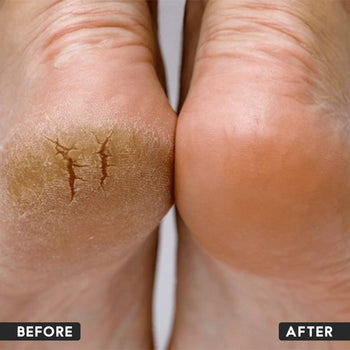 Foot Butter Cream