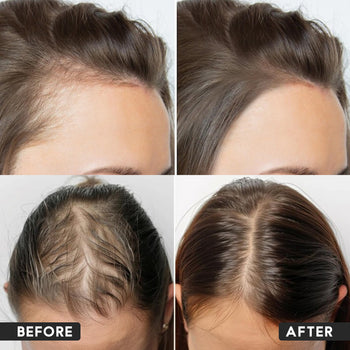 Hair Serum (Hair fall control & Hair growth)
