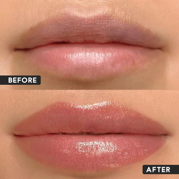 Lip Serum For Dark Lips