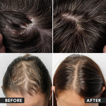 Anti Hair Fall Kit