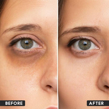 Under Eye Cream for Dark Circles
