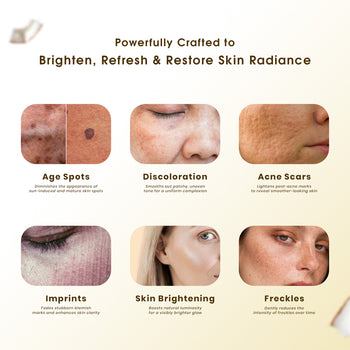 ಸ್ಕಿನ್ ಲೈಟನಿಂಗ್ ಕ್ರೀಮ್ (30 ಗ್ರಾಂ)...