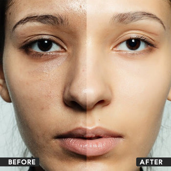 Skin Lightening Cream with Goat Milk Soap