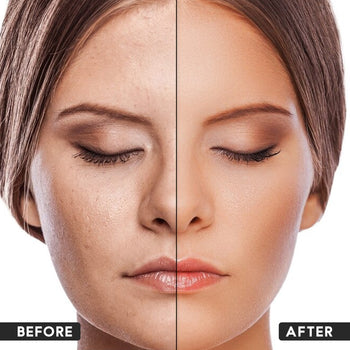 ಮಾಯಿಶ್ಚರೈಸರ್ ಕ್ರೀಮ್ (30 ಗ್ರಾಂ)...