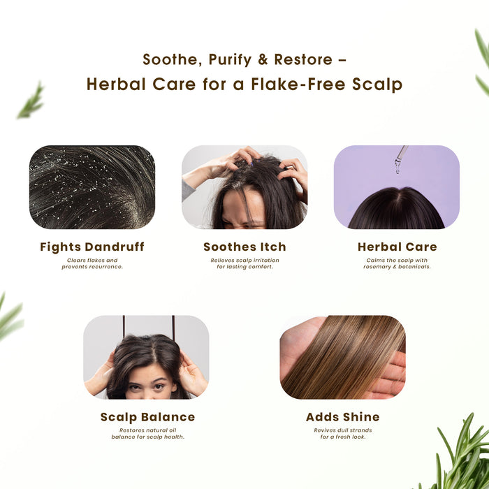 Rosemary Dandruff Defense